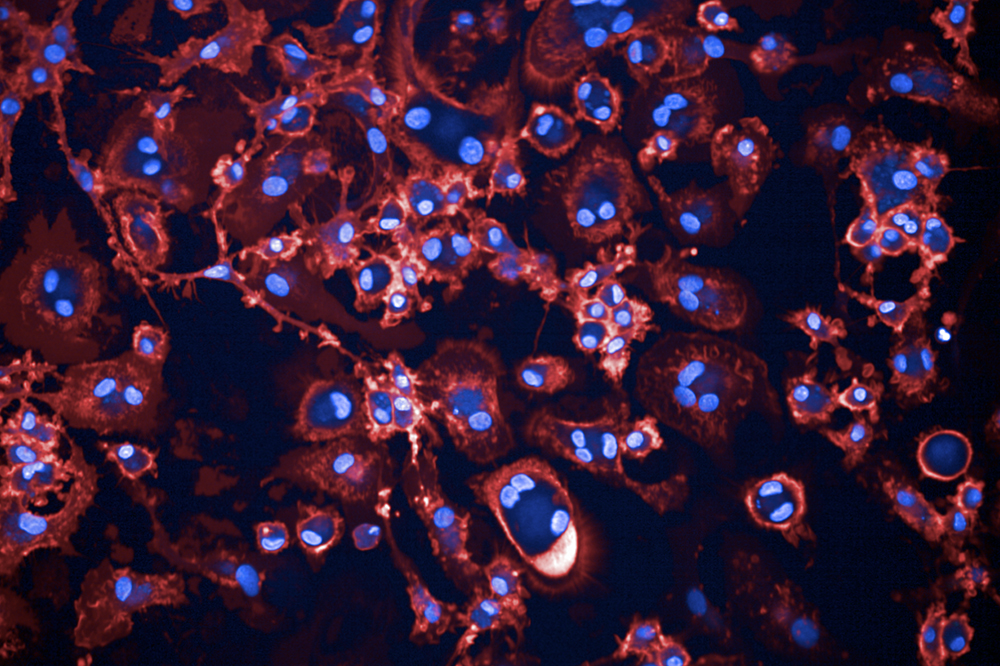 Cellbox IPSC