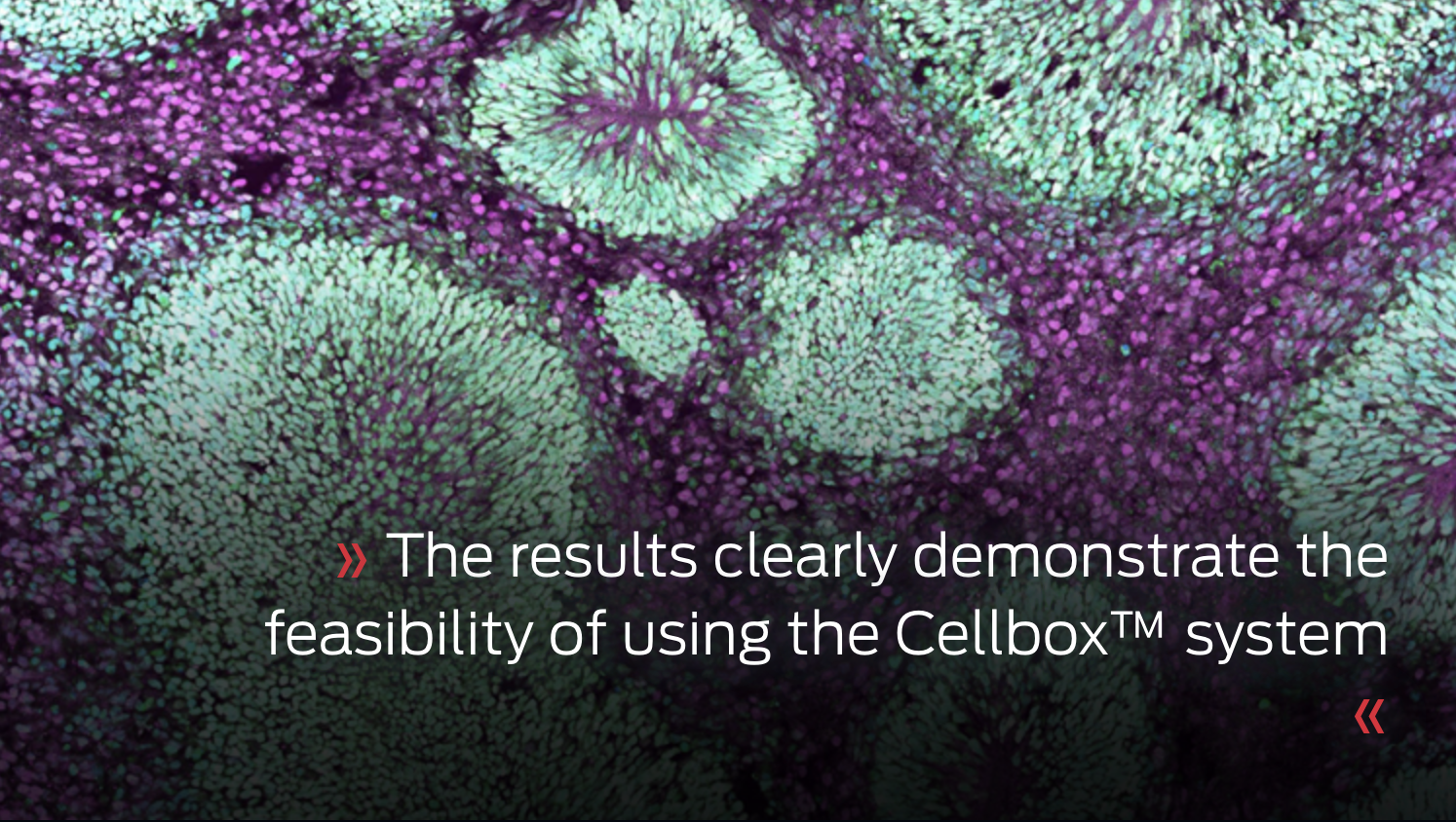Functional Assessment of Brain Organoids After Transport | Cellbox ...