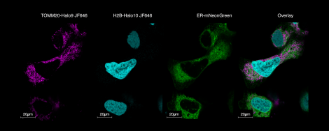 Live Cell Imaging of immortalized osteosarcoma cell line using the Leica Stellaris 8 TauSTED